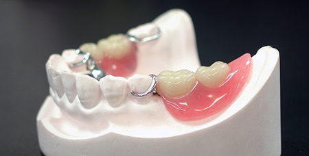 入れ歯からインプラントにする タキザワ歯科クリニック インプラントサイト
